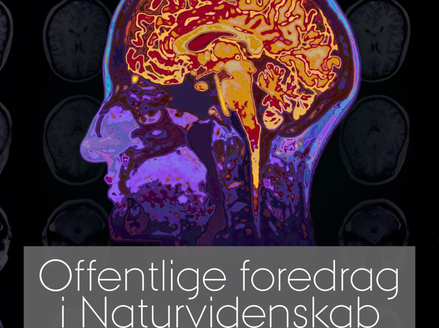 Scanningsbillede af en hjerne. Aarhus Universitet foredrag 2025